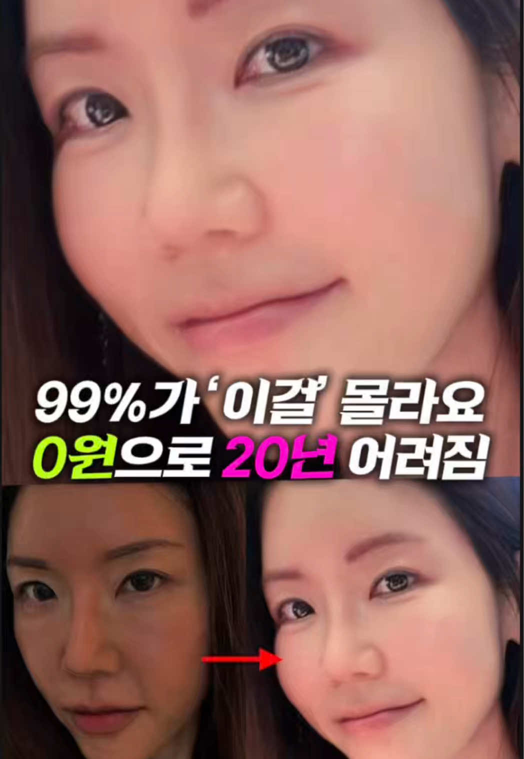 @지나스 GINAS