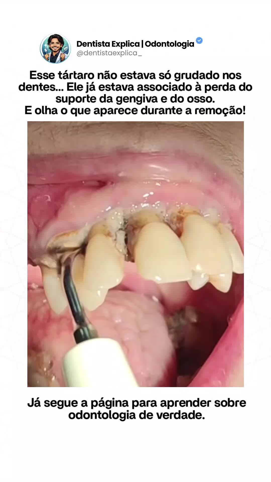 @Dentista Explica | Odontologia