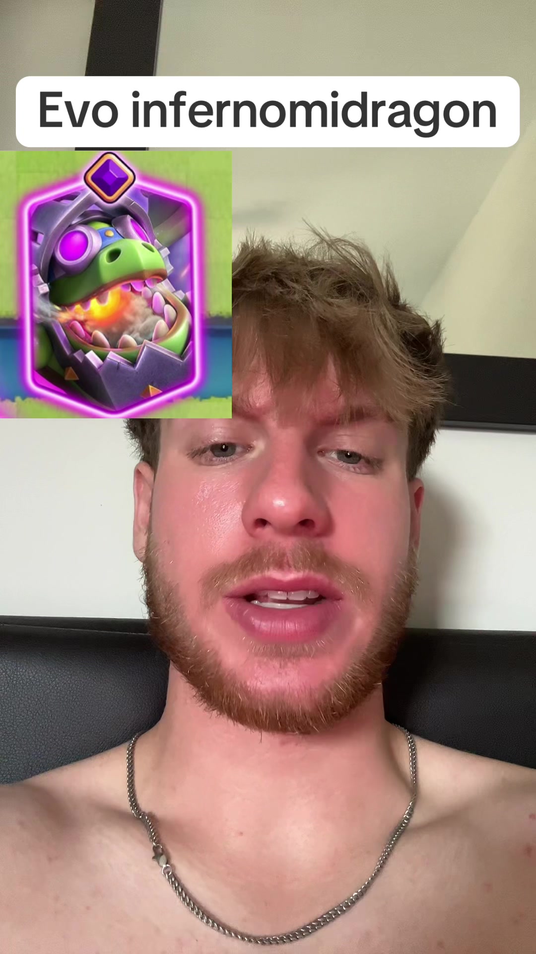 @fettion