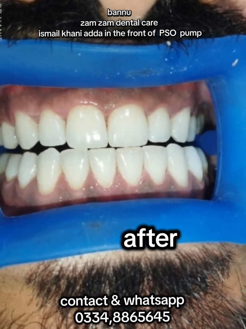 @DrHanif Dental Studio