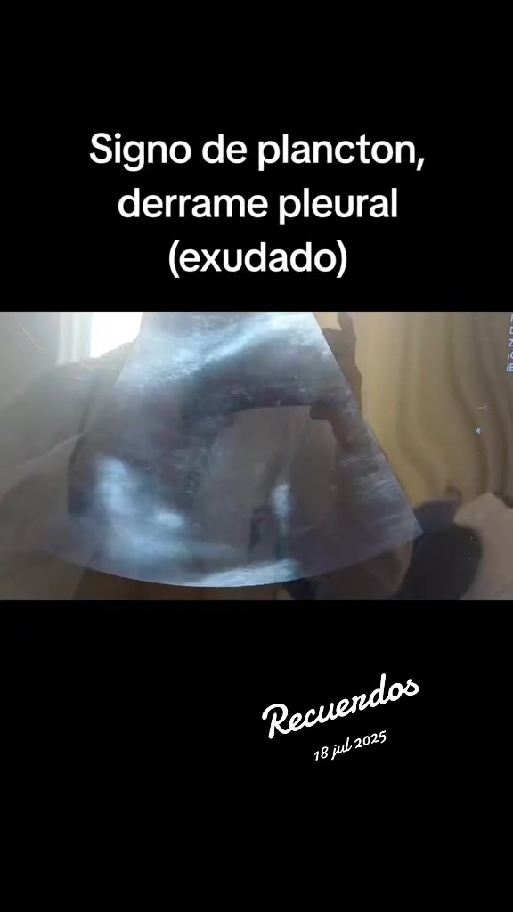 @Dr. Ajolote.