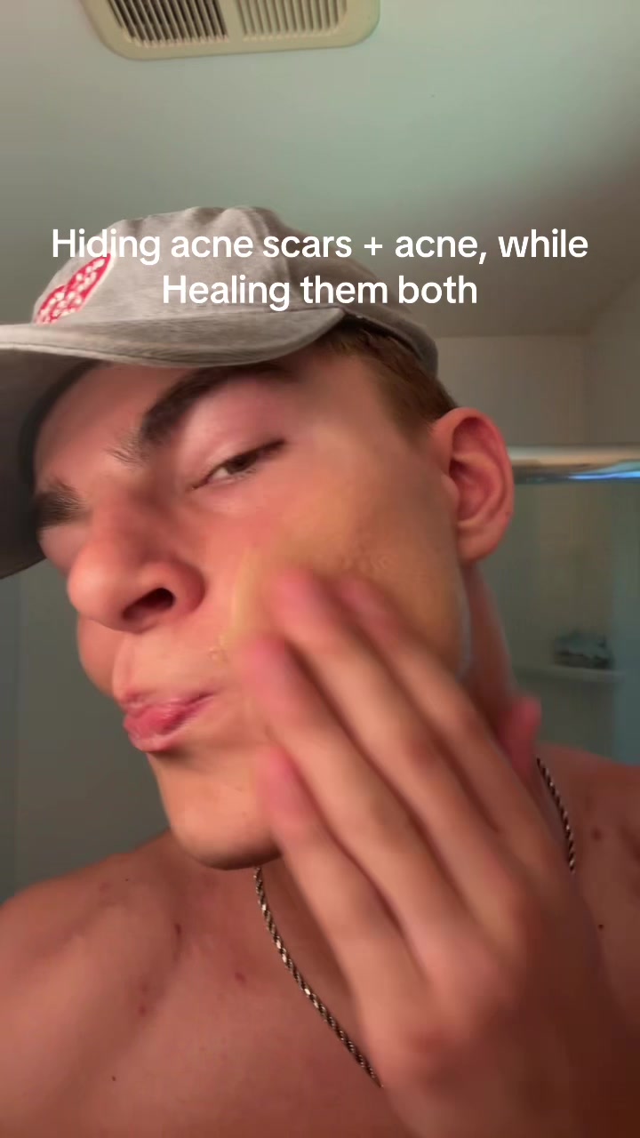 @Finn