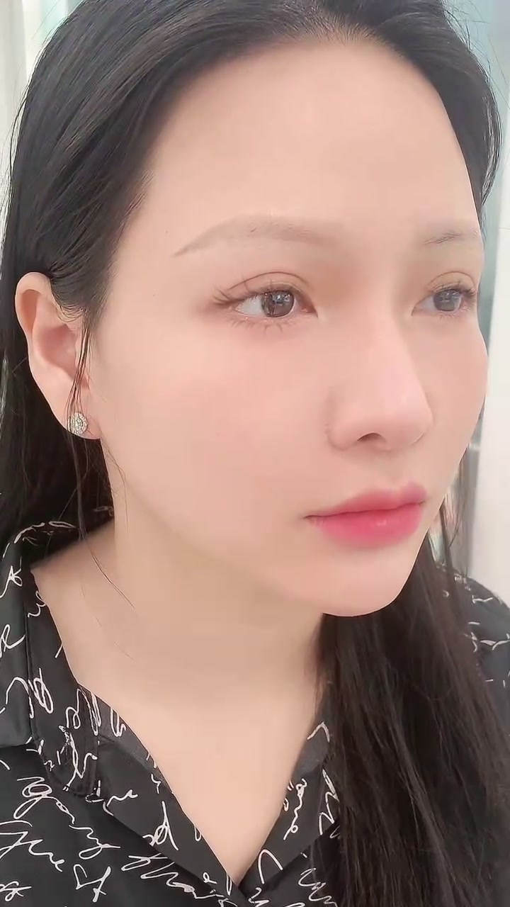 @Viện Thẩm Mỹ Hena
