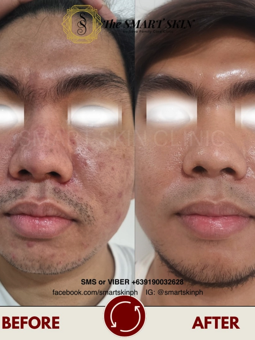 @The Smart Skin- Malolos