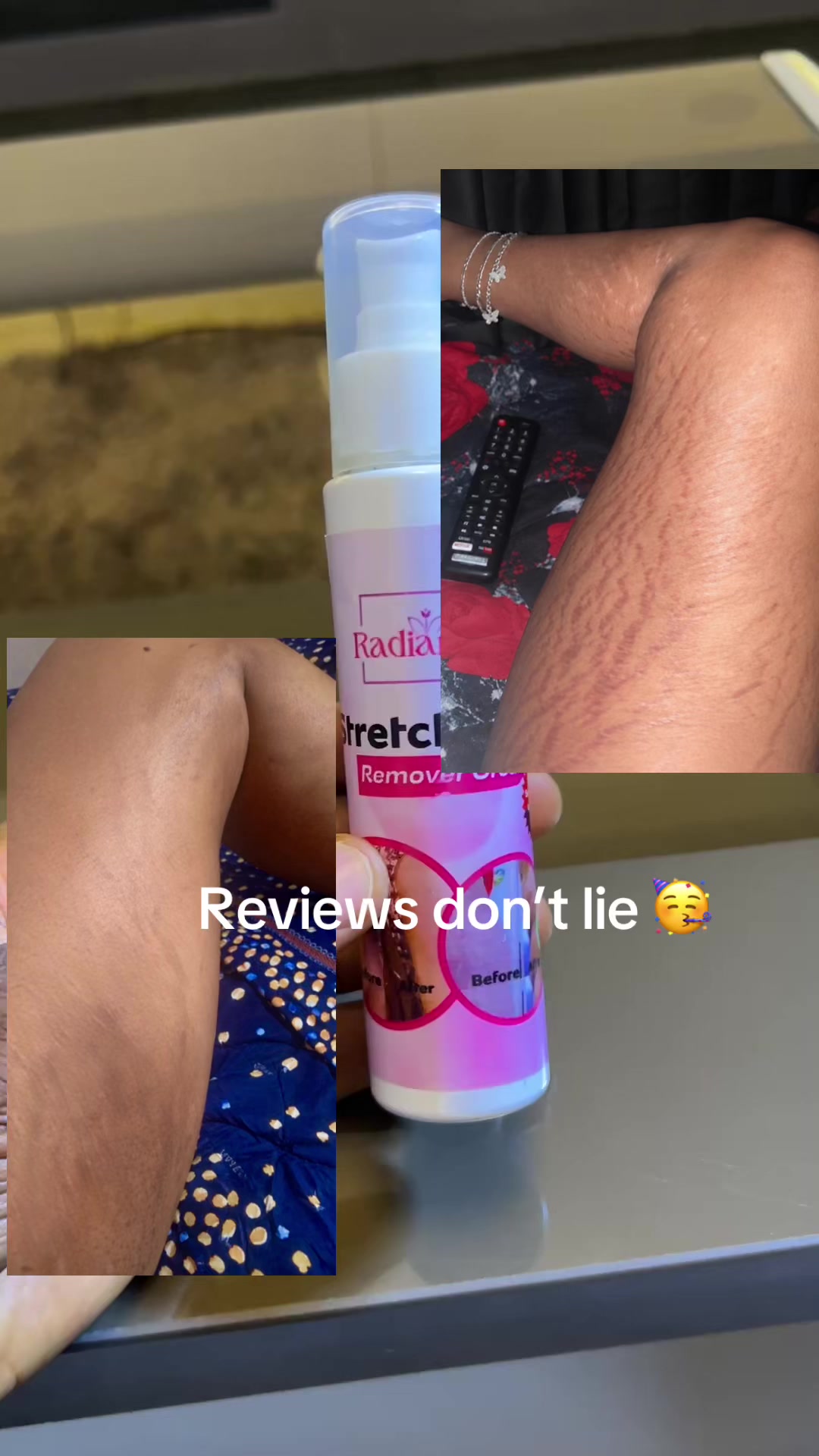 @Radiant skin