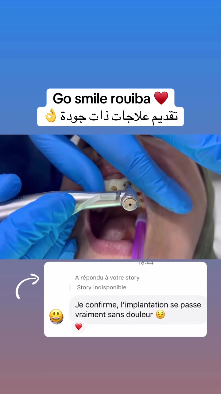 @GOSMILE ROUIBA🇩🇿