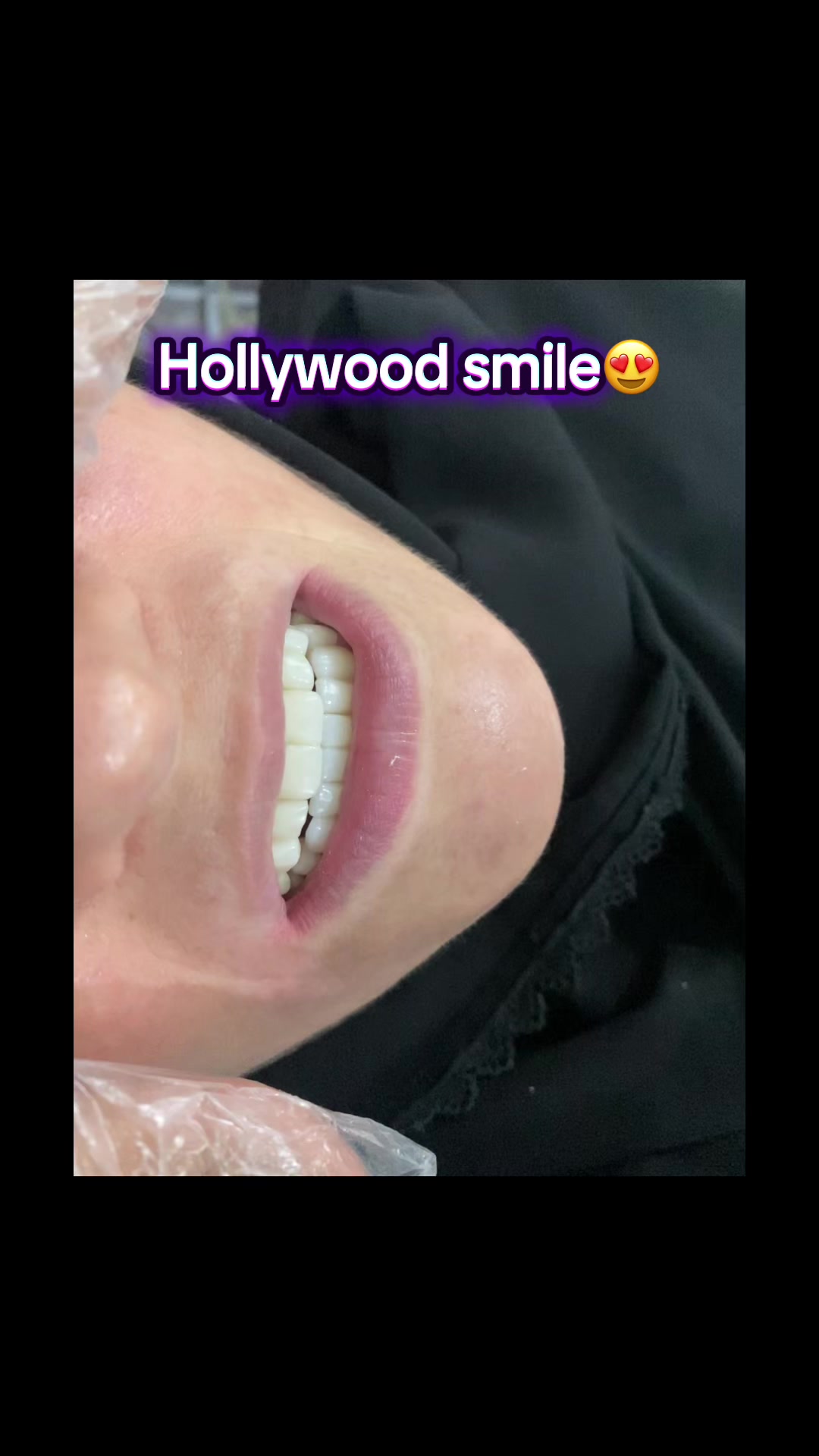 @dr_meher_official