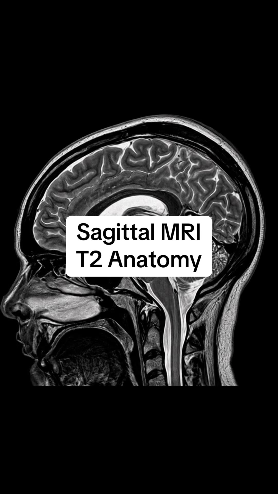 @Sobat Radiology