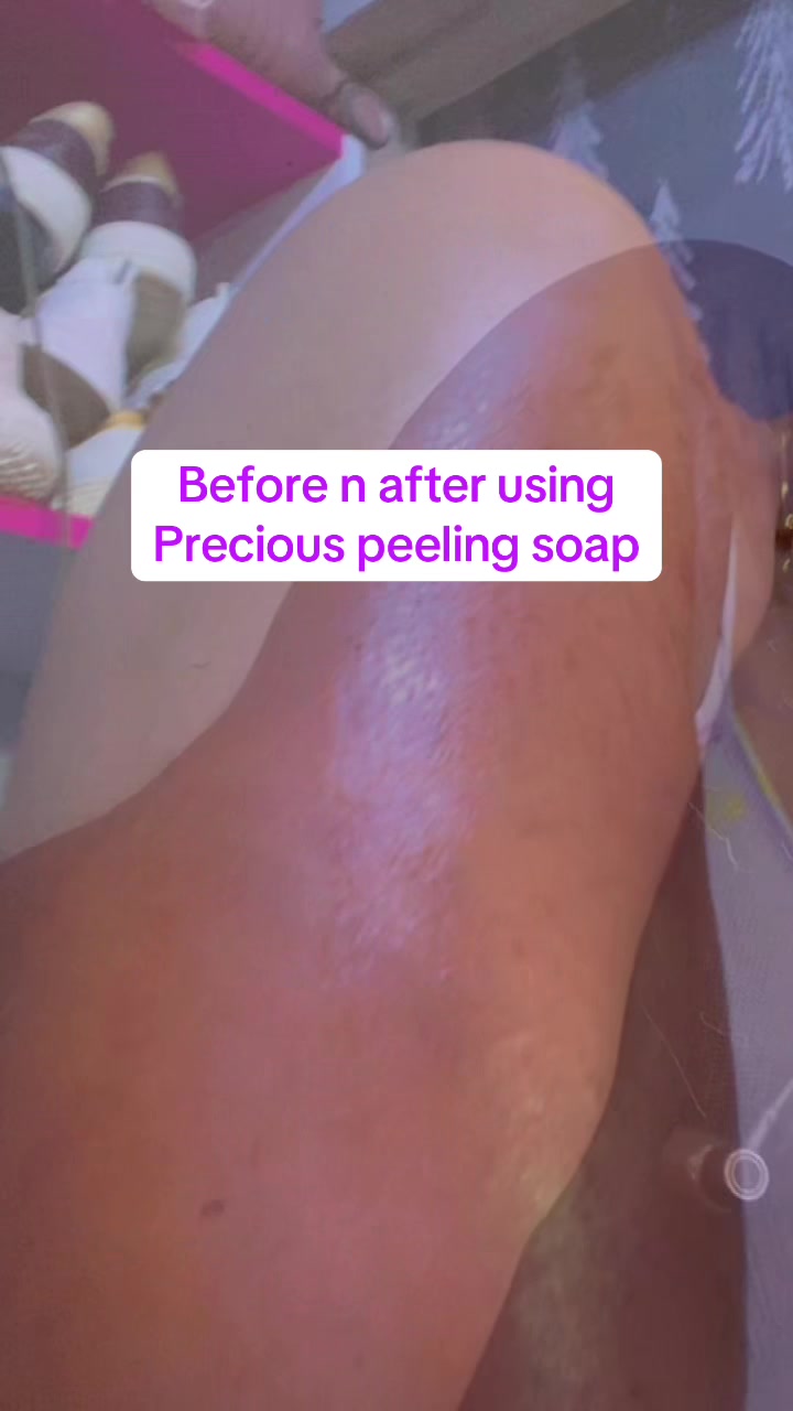 @@ Precious peeling soap