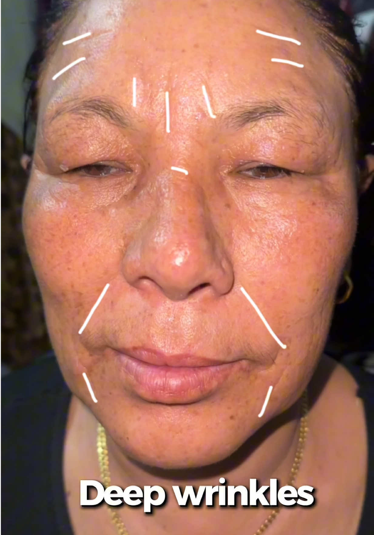 @Minimagic Skincare🇳🇵