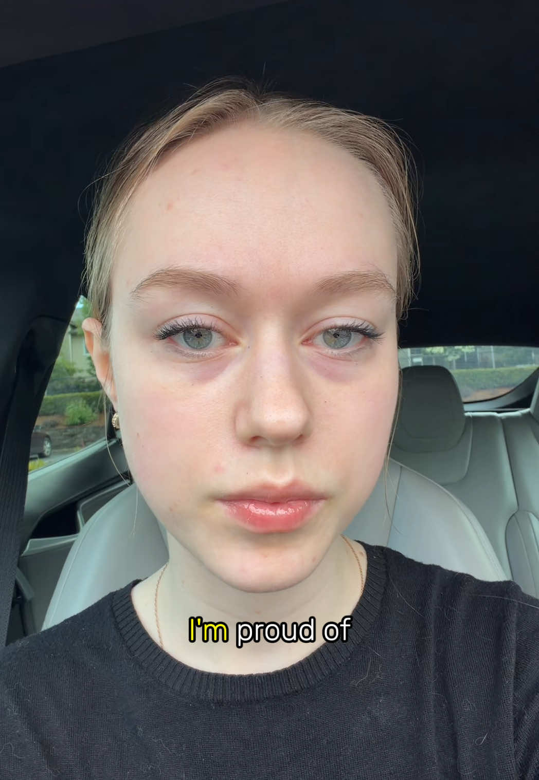 @bailey.schildbach