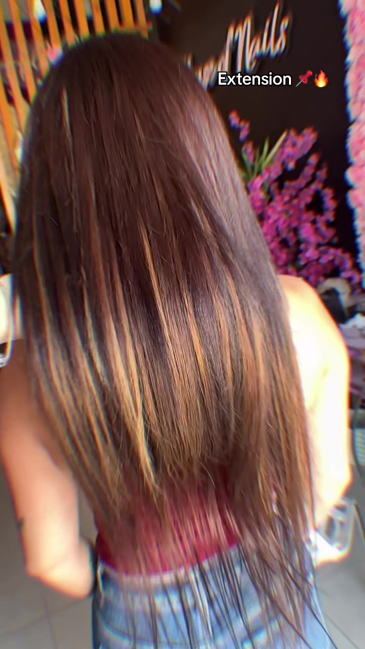@xhenis_estetik