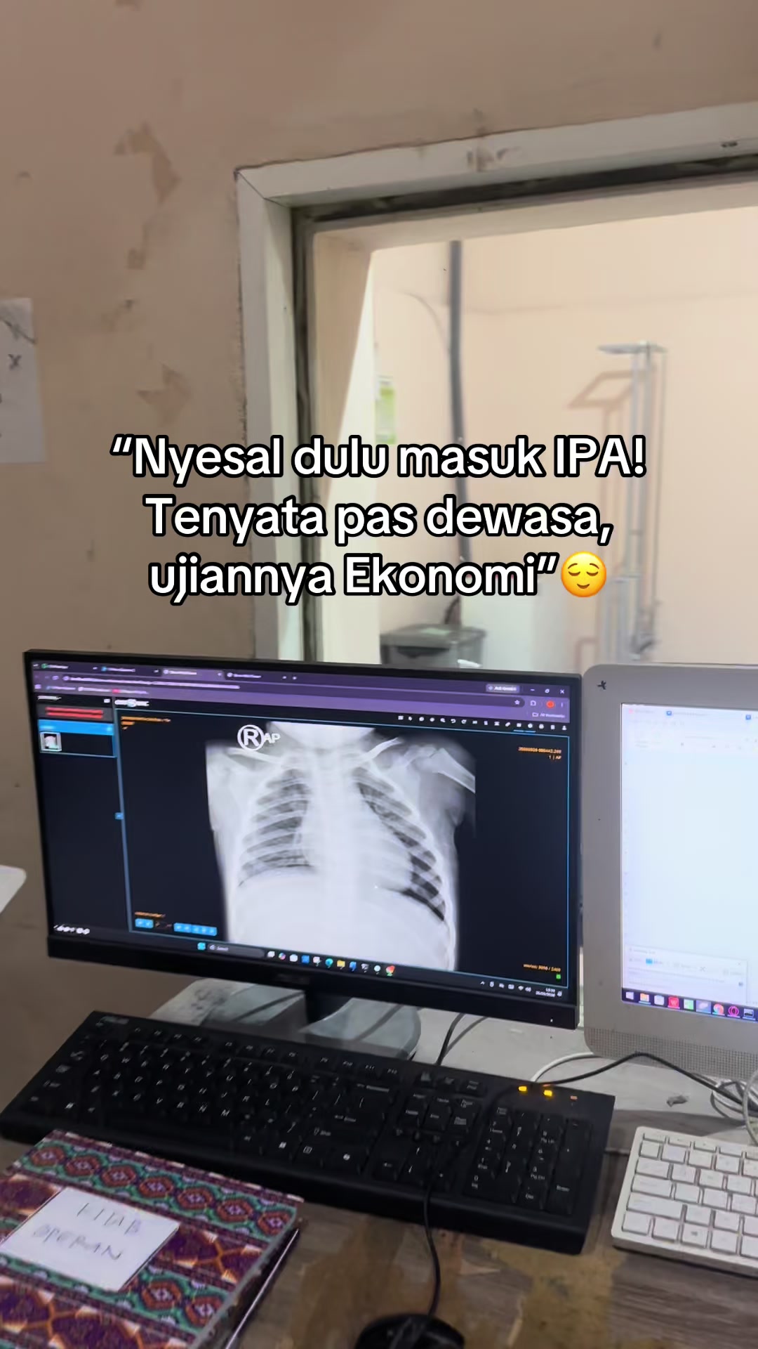 @Sobat Radiology