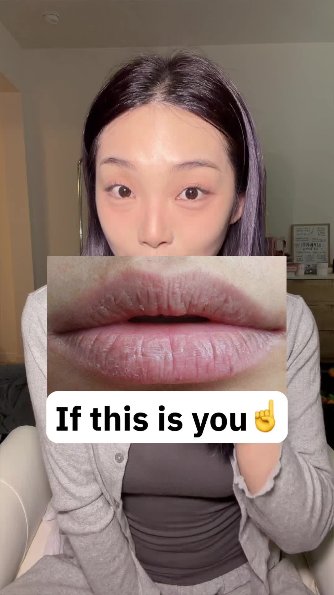 @lily