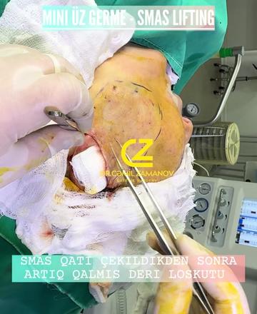 @Dr.Zamanov_Cemil