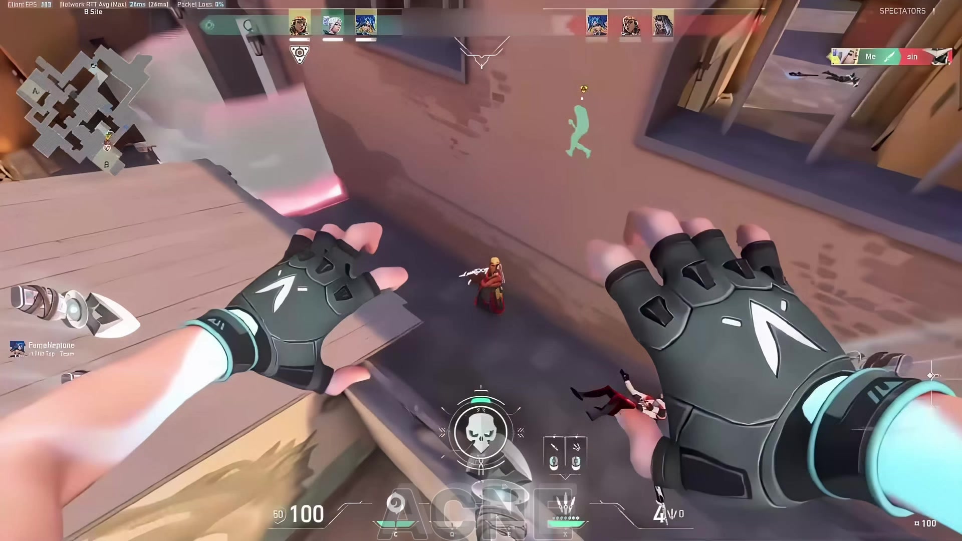 @acnefractured