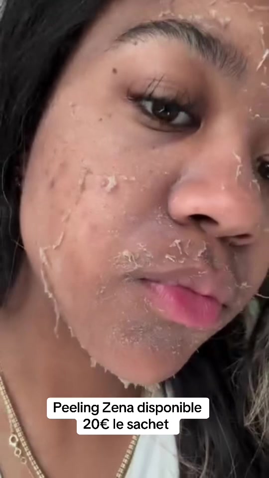 @peeling_zena