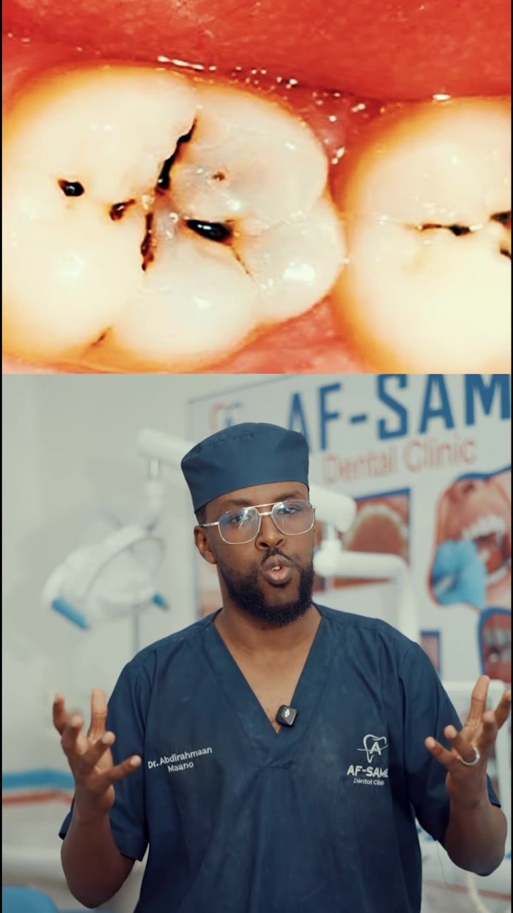 @Dr. Maano 🦷
