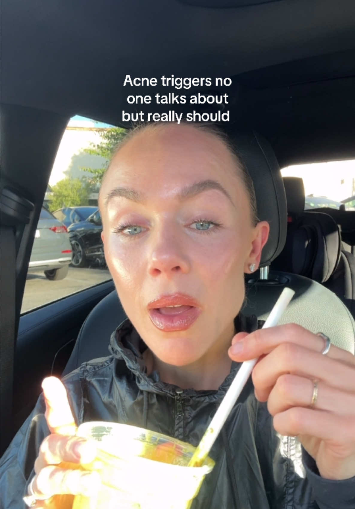 @Celeste | RN acne expert