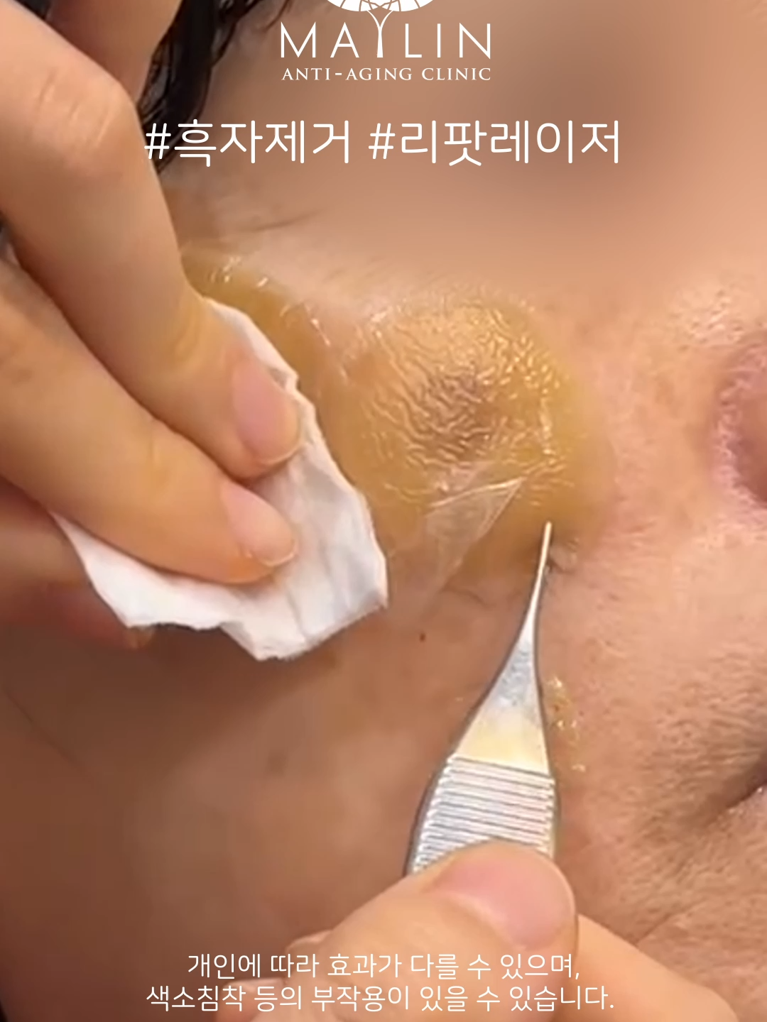 @메이린의원대구점