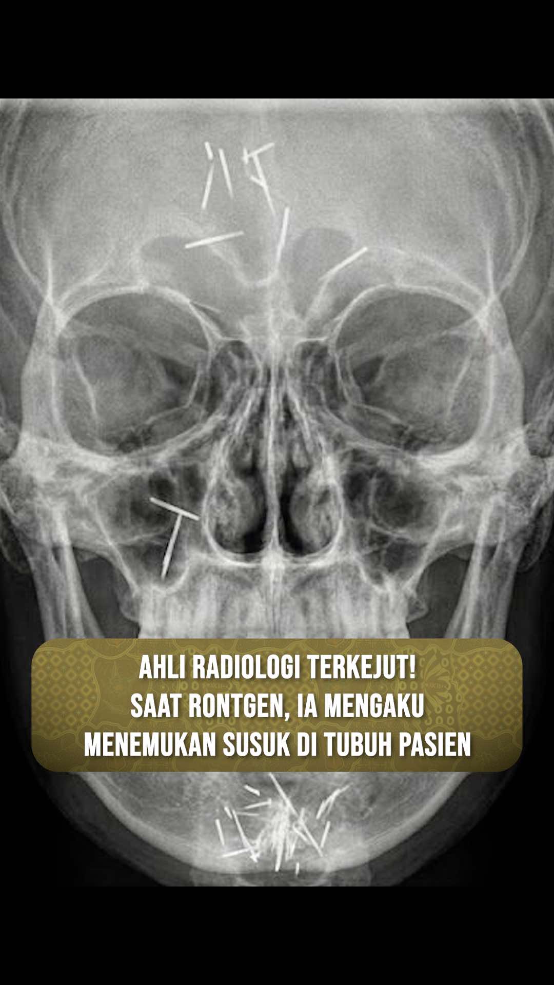 @RJL 5 Official