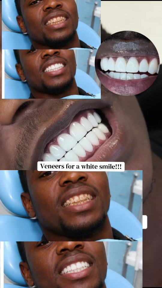 @Dr~MUJUNI 🦷🇺🇬✅