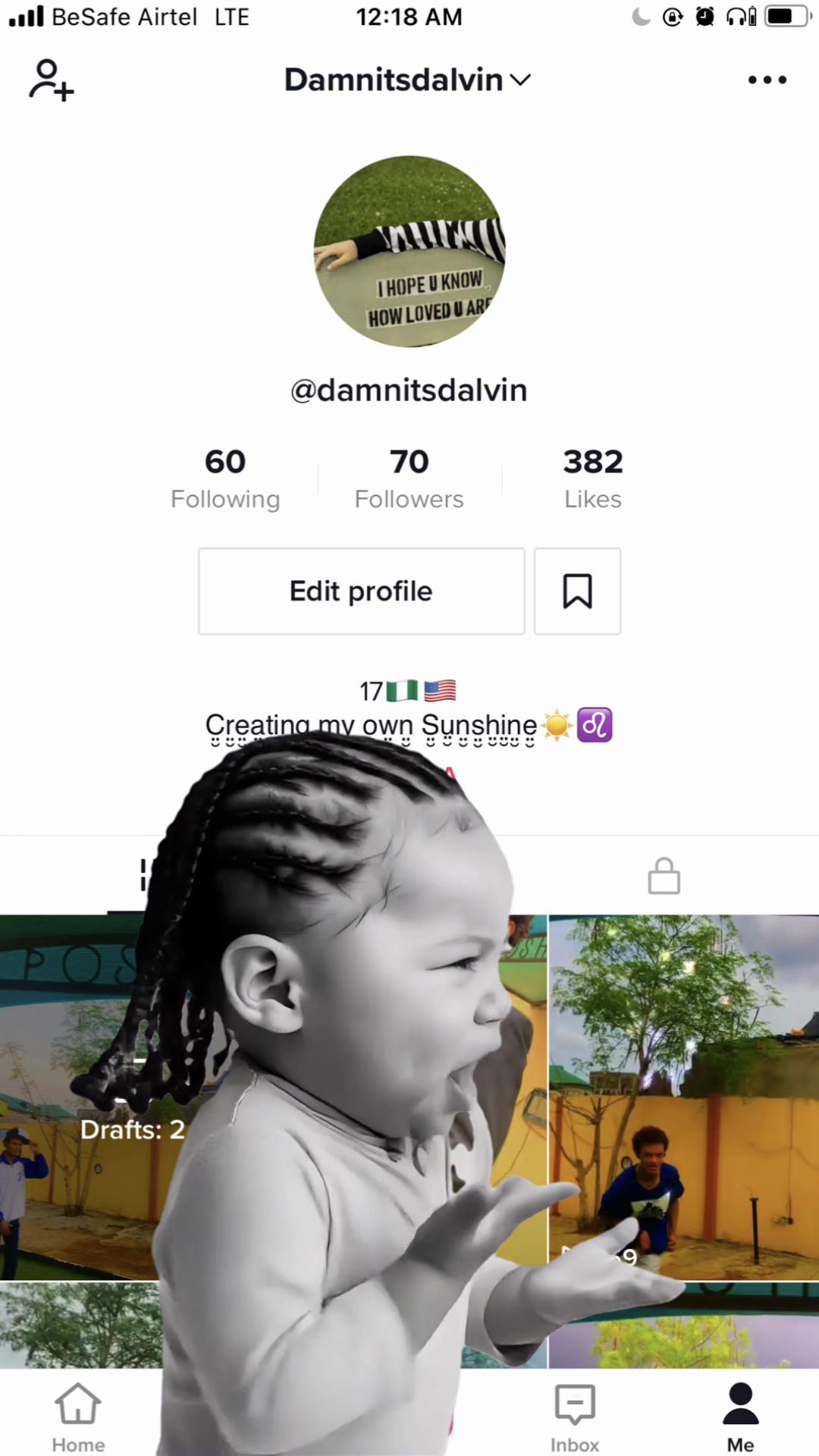 @Dalvinnxtdoor🫠