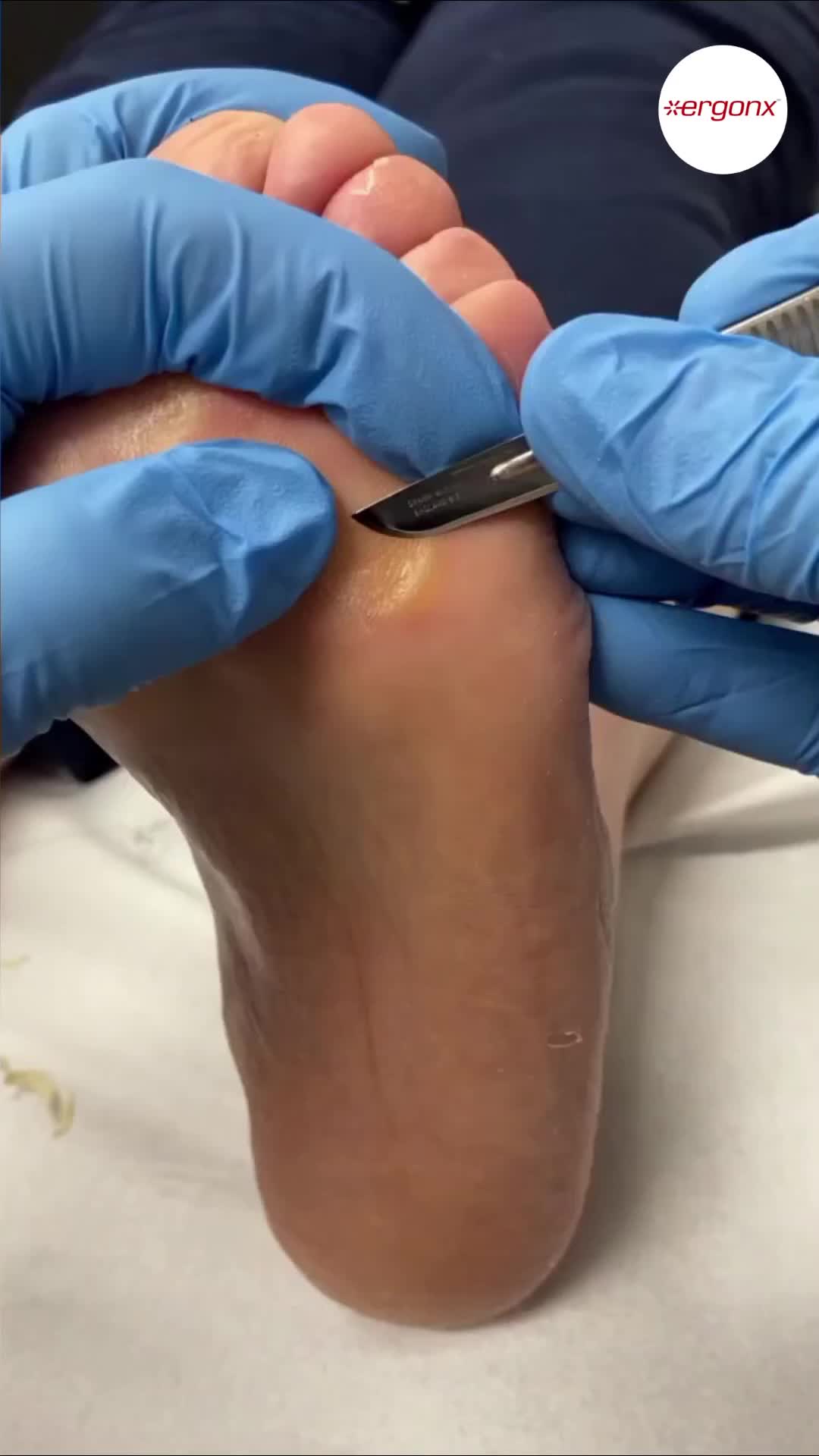 @ergonx