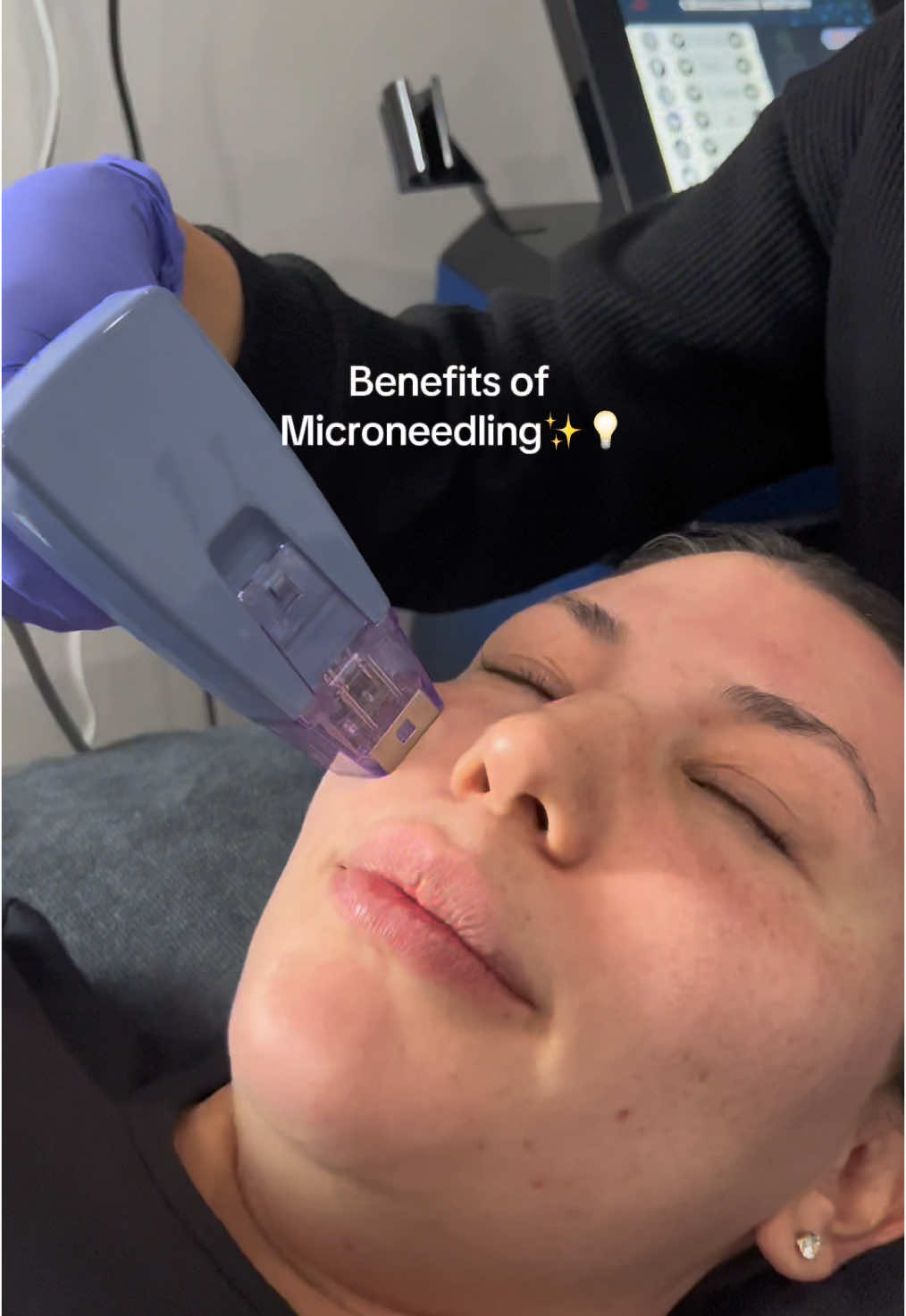 @Opal MD Aesthetics