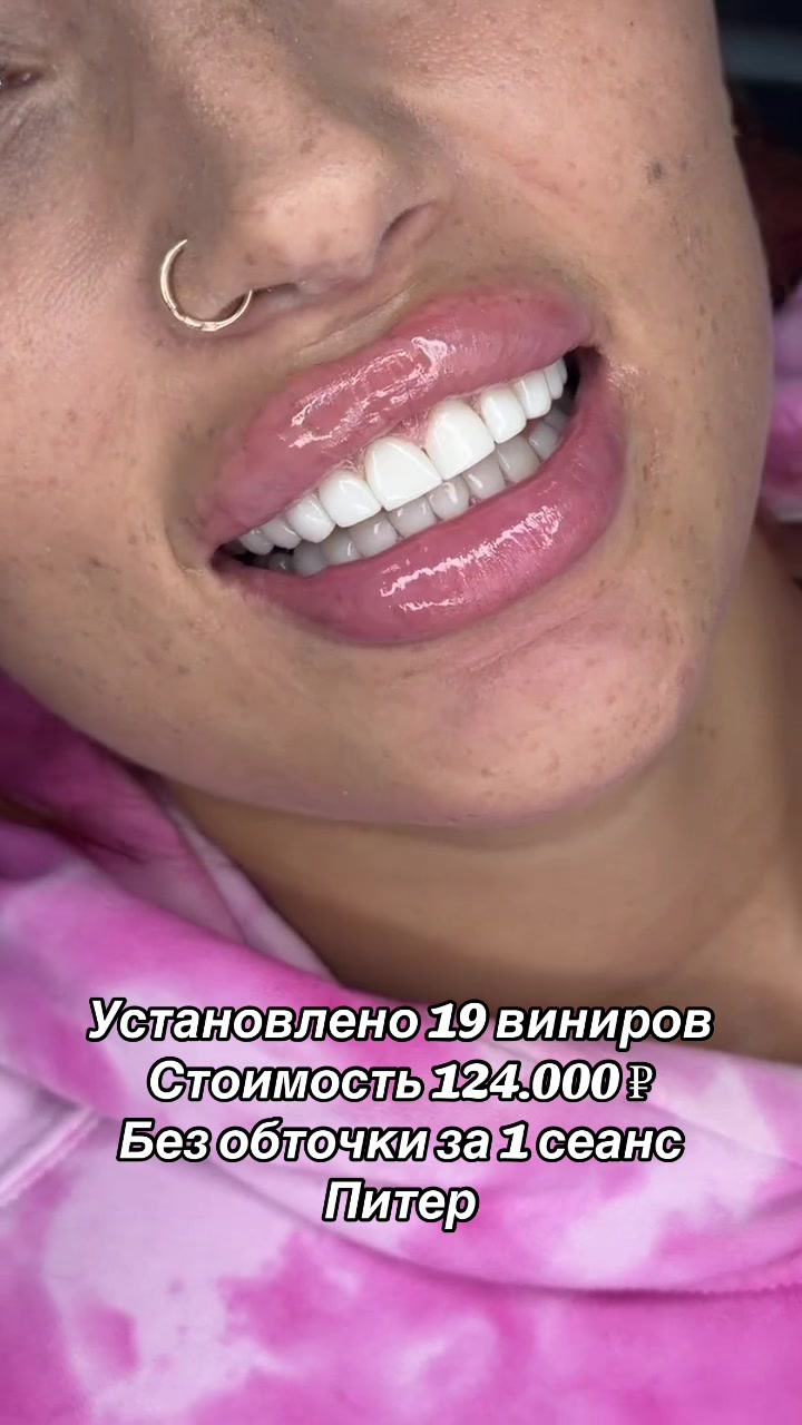 @Royal_smile_moscow