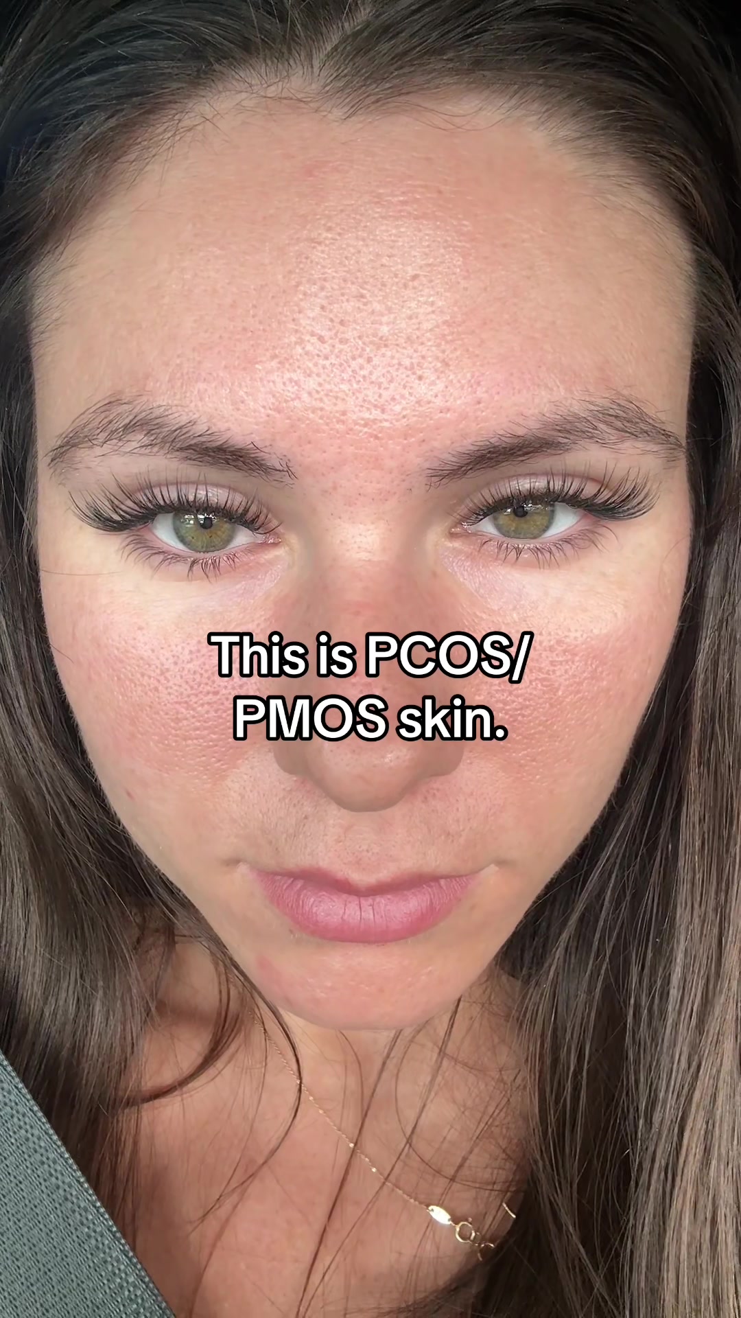 @Sarah | PMOS/PCOS life + tips