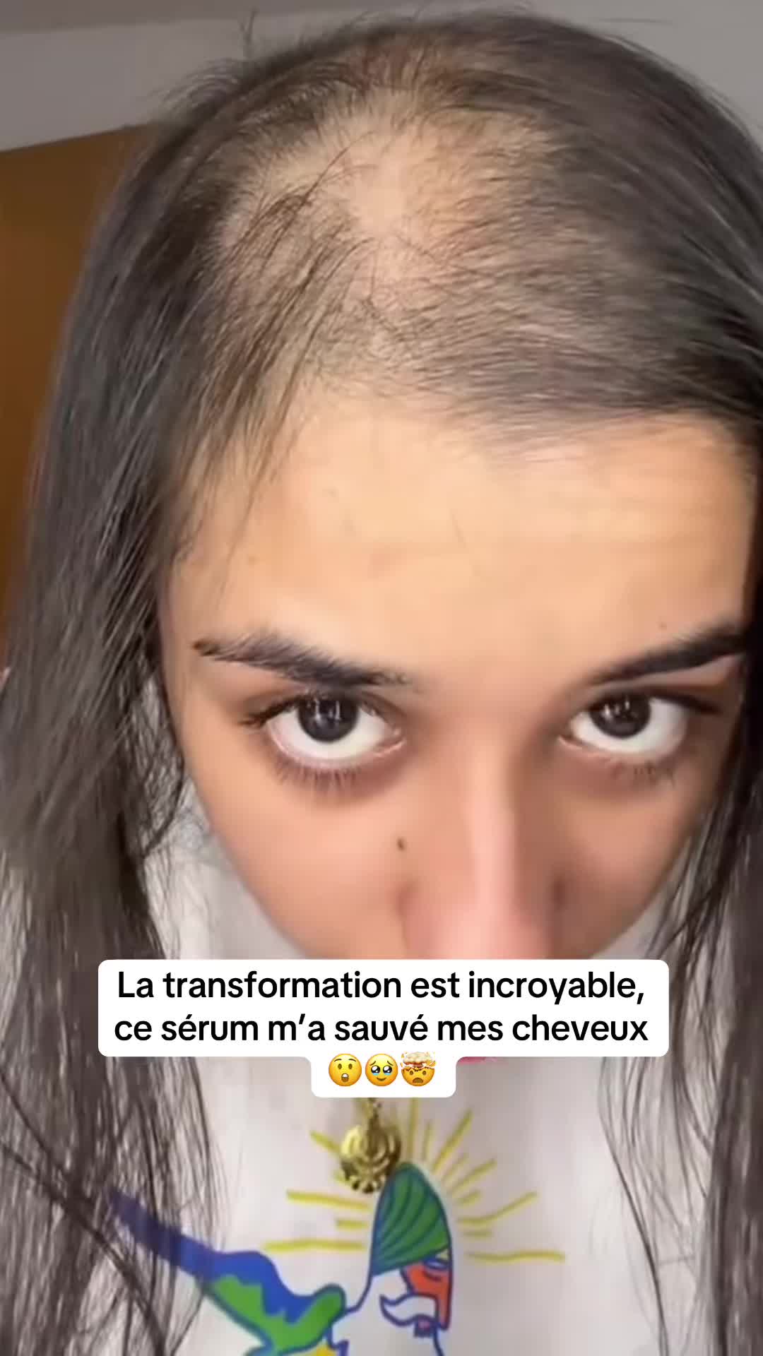 @Lux’Hair Growth FR