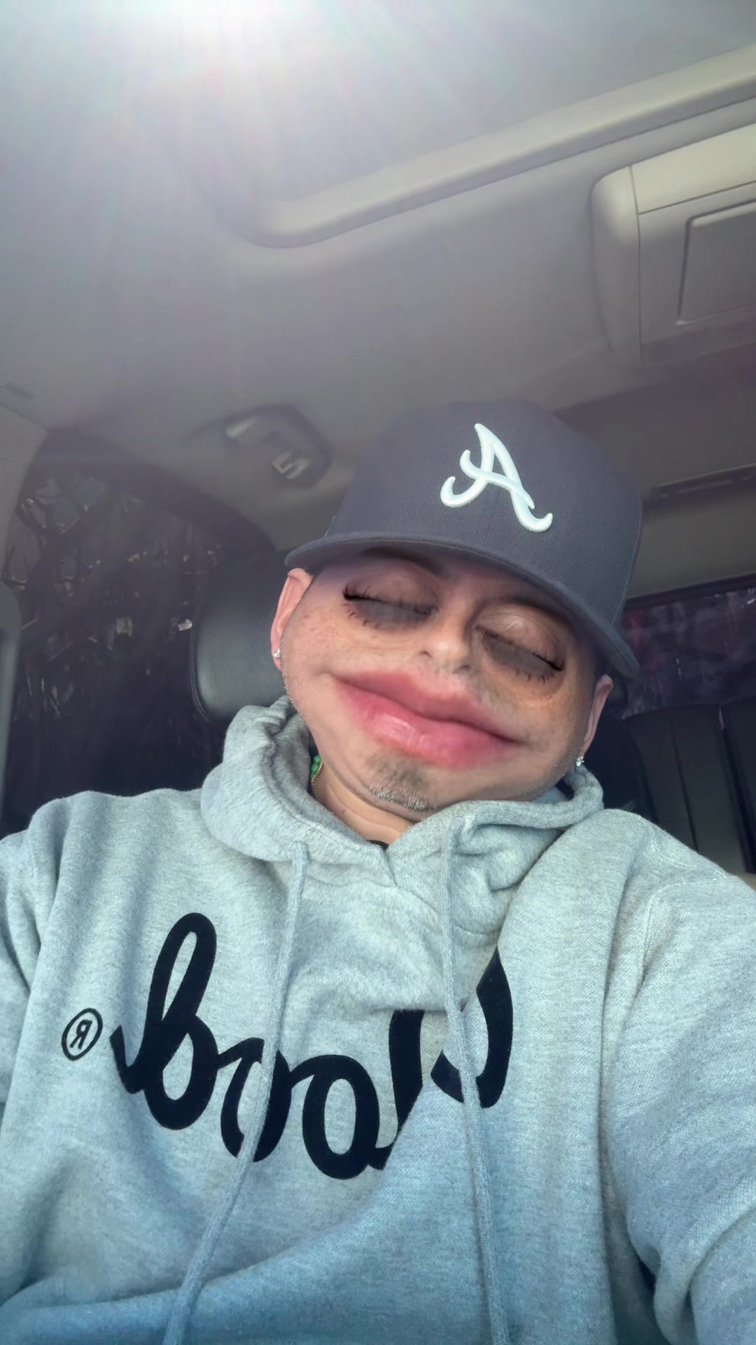 @MP