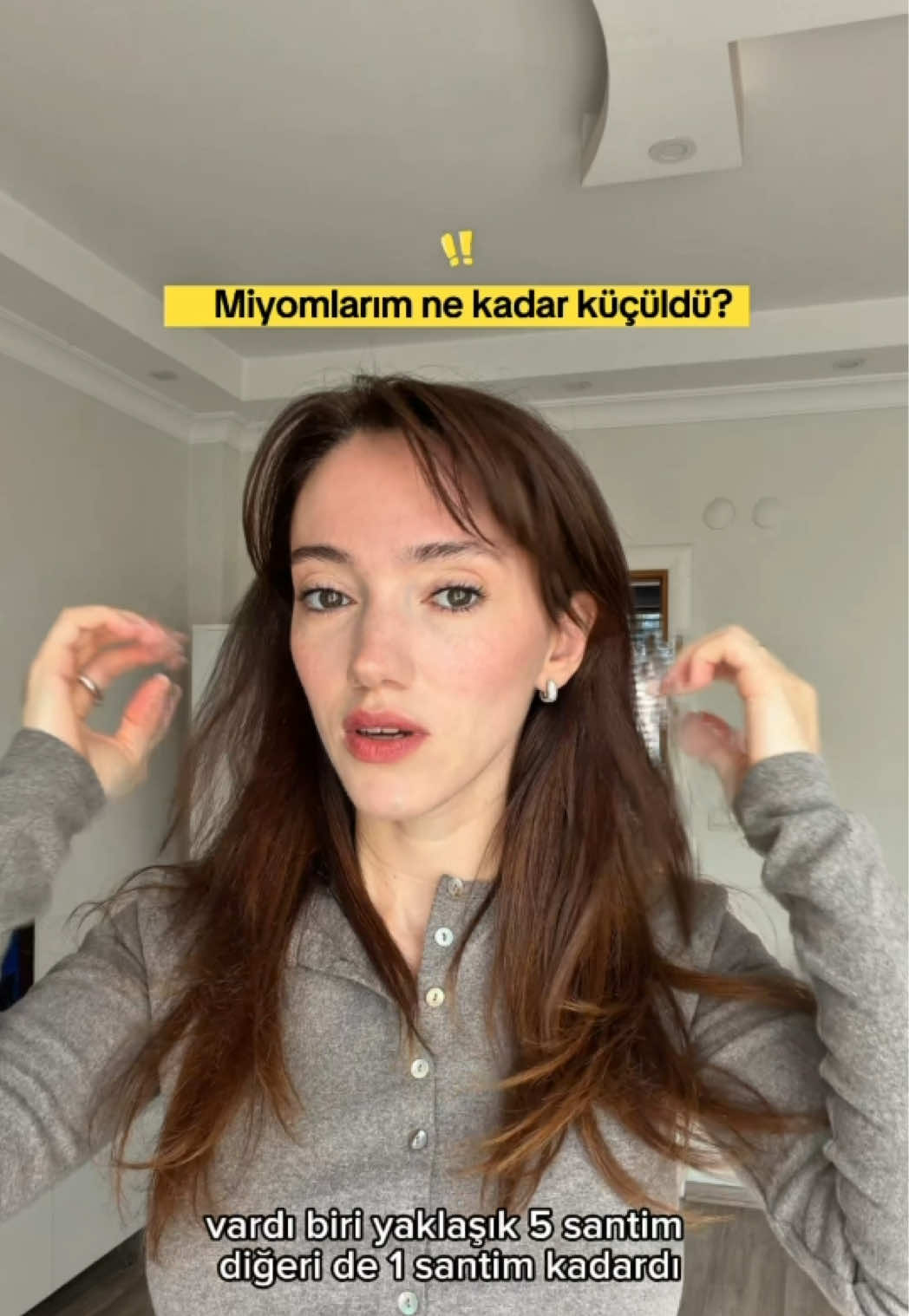 @Elif Solmaz