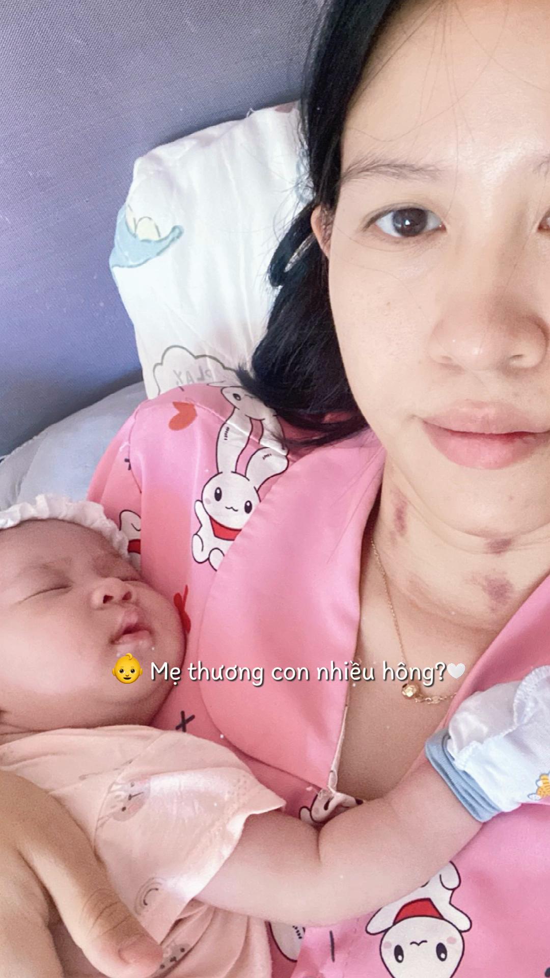 @Ebe chữa l&agrave;nh