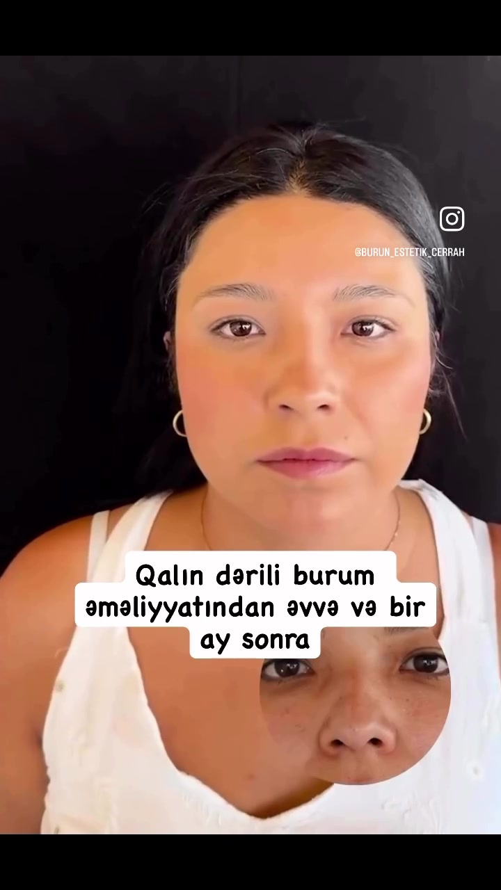 @Estetik_cerrah