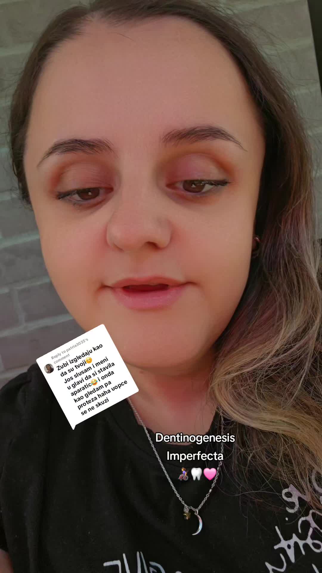 @Arbnora Elezi👩🦽