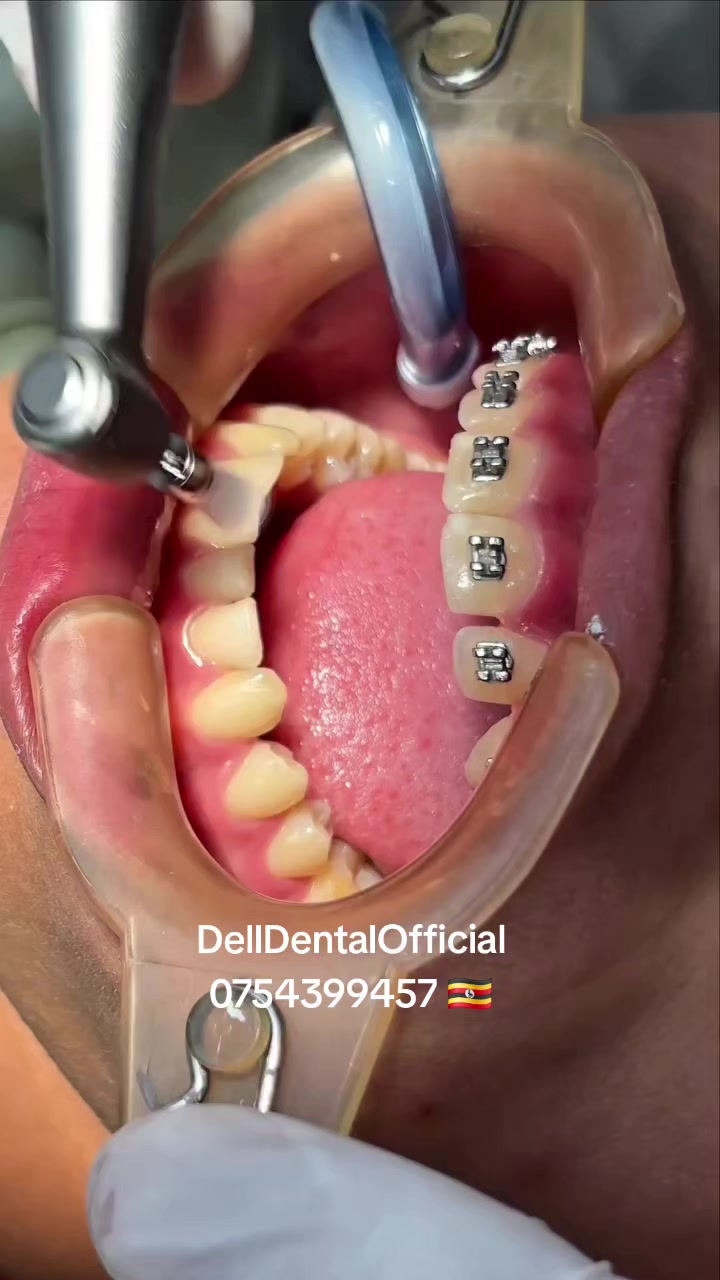 @DellDentalOfficial