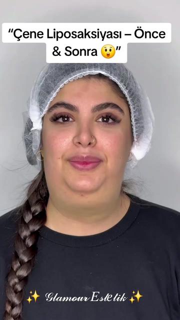 @Glamour Estetik Official