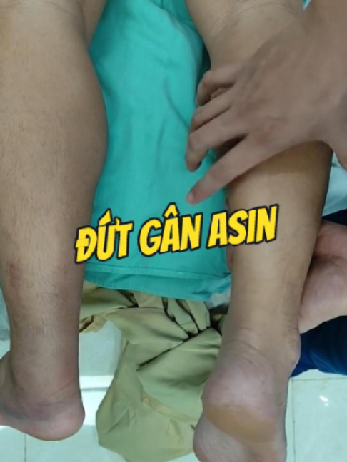 @Chuyên gia xương khớp