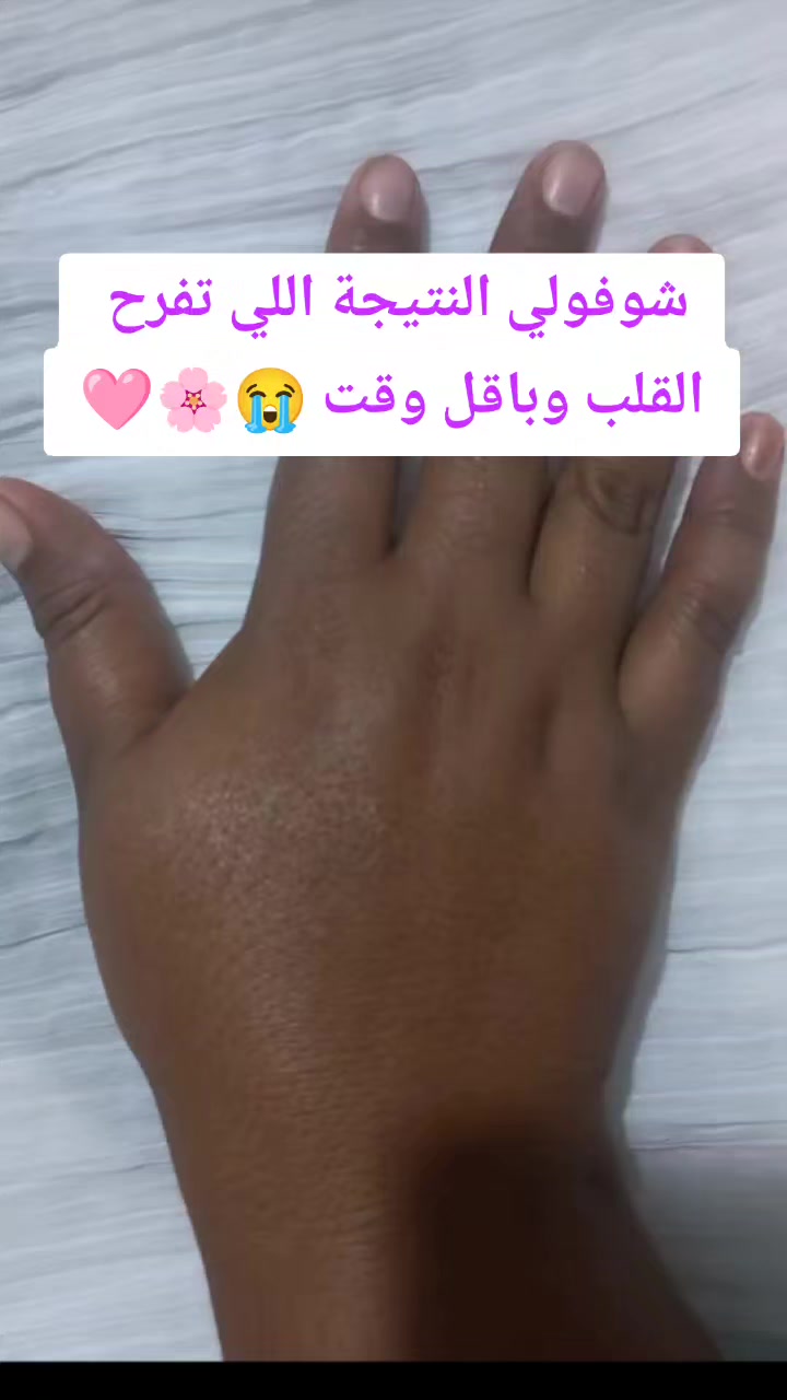 @أسرار الجمال مع ام سعود🎀