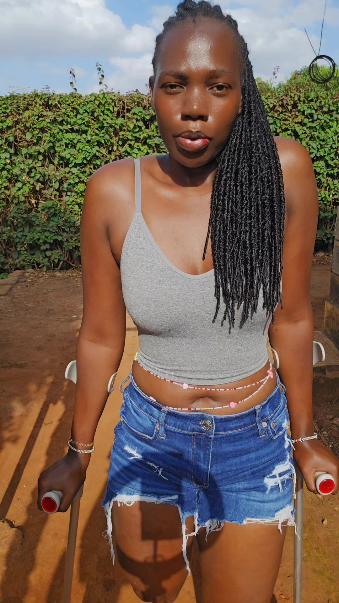 @💎Nattie Amputee🇰🇪♊️