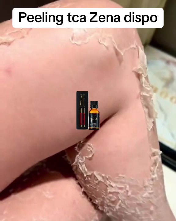 @peeling_zena