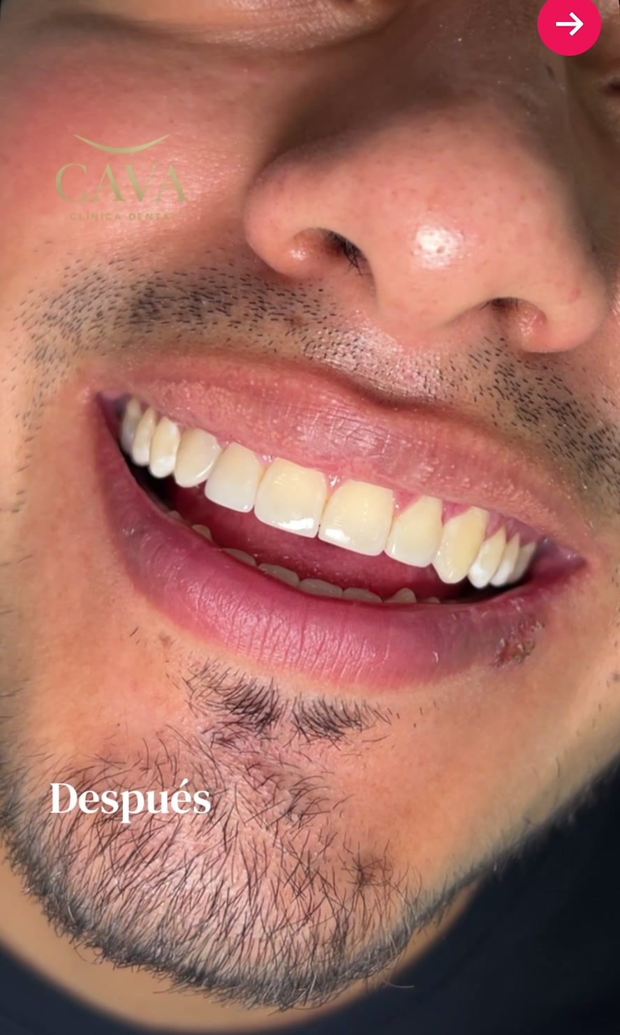 @Cava Cl&iacute;nica Dental 🦷