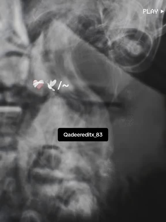 @Qadeer Editx ❤️🩹