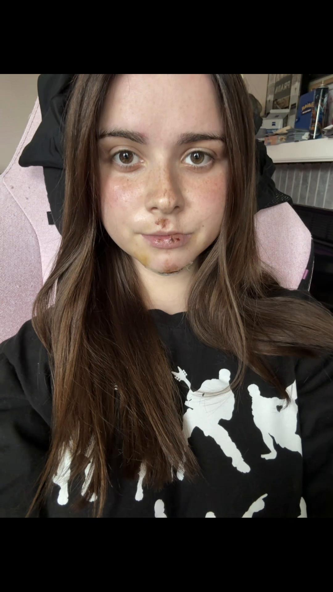 @autumnraynn