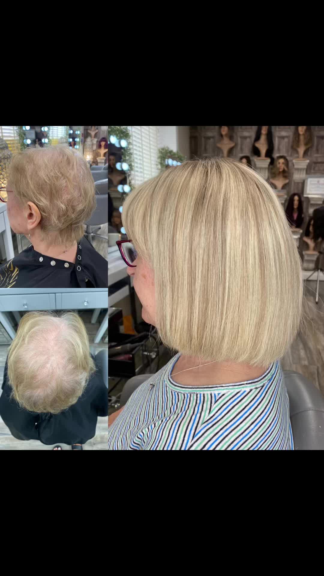 @Godiva Hair Loss Specialists
