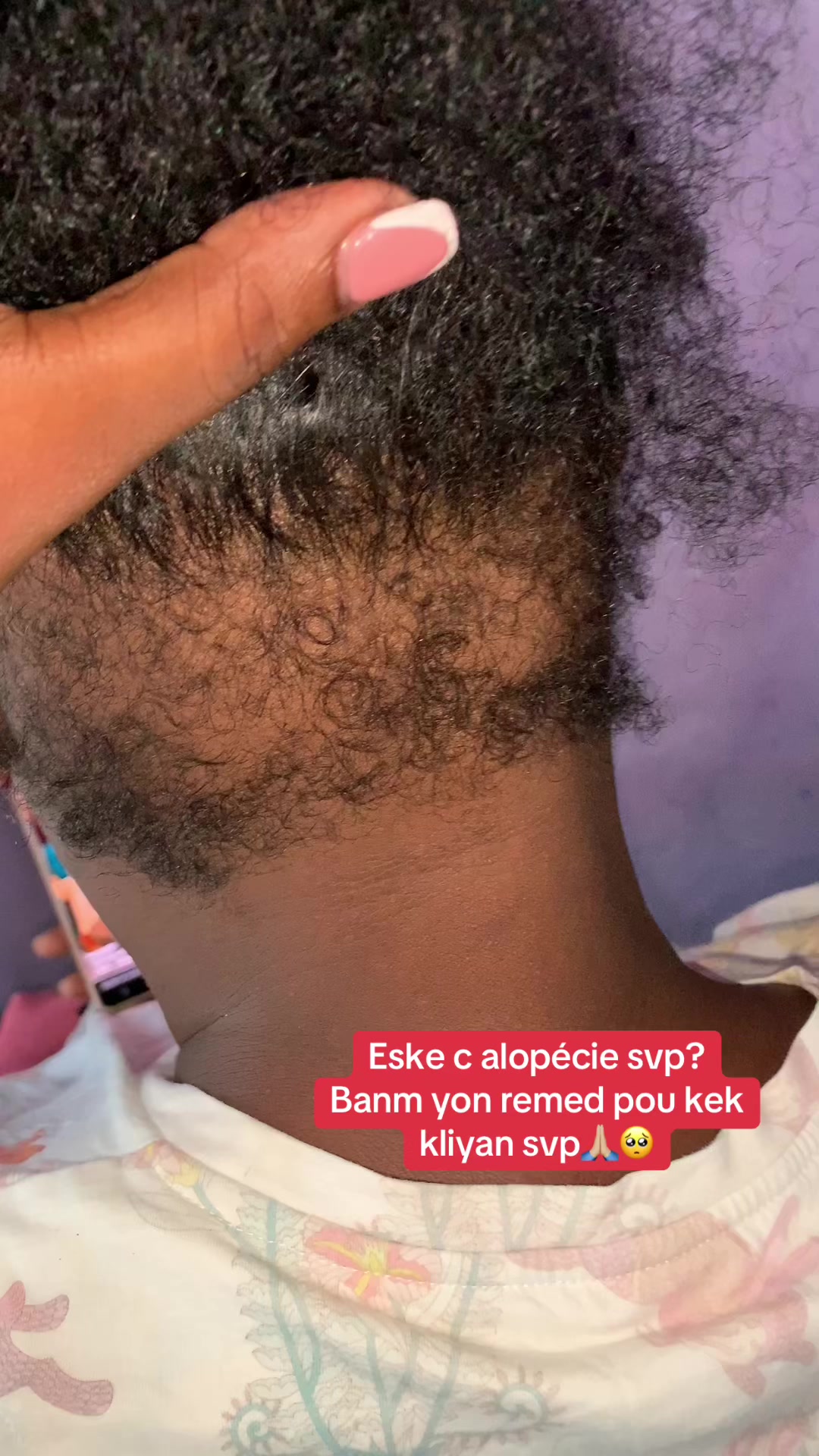 @Bel'Hair🦋🥰