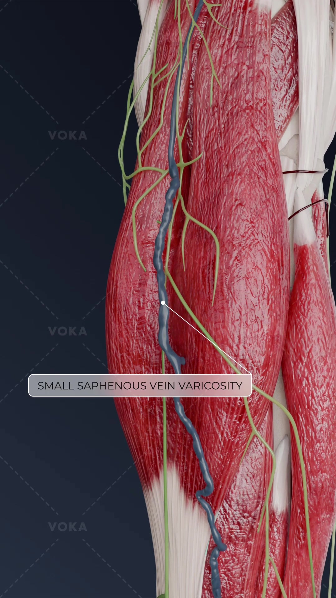 @VOKA 3D Anatomy & Pathology