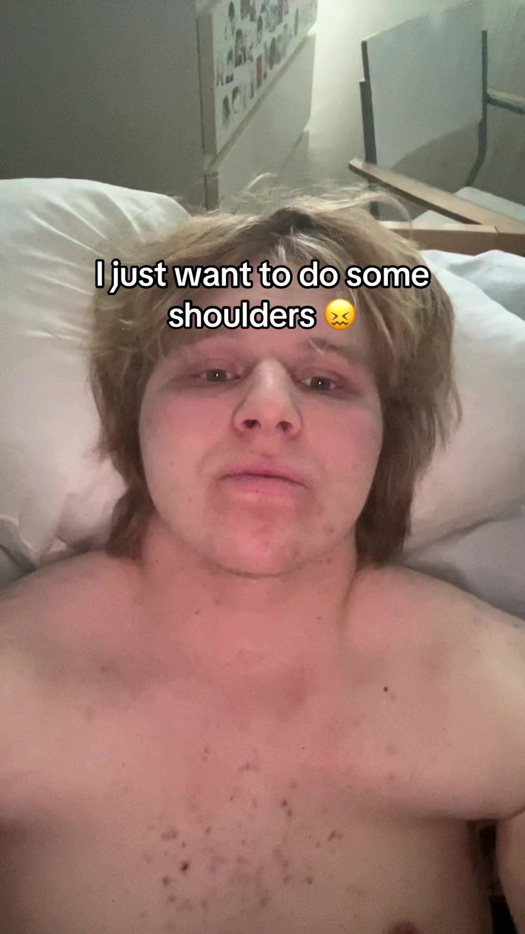 @#1 paralyzed Mogger